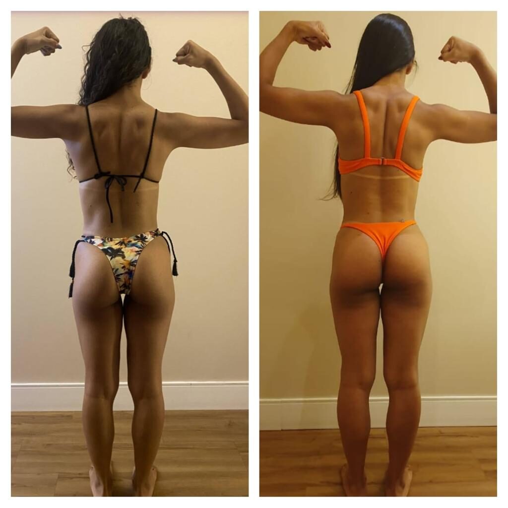 antes e depois crioturbo