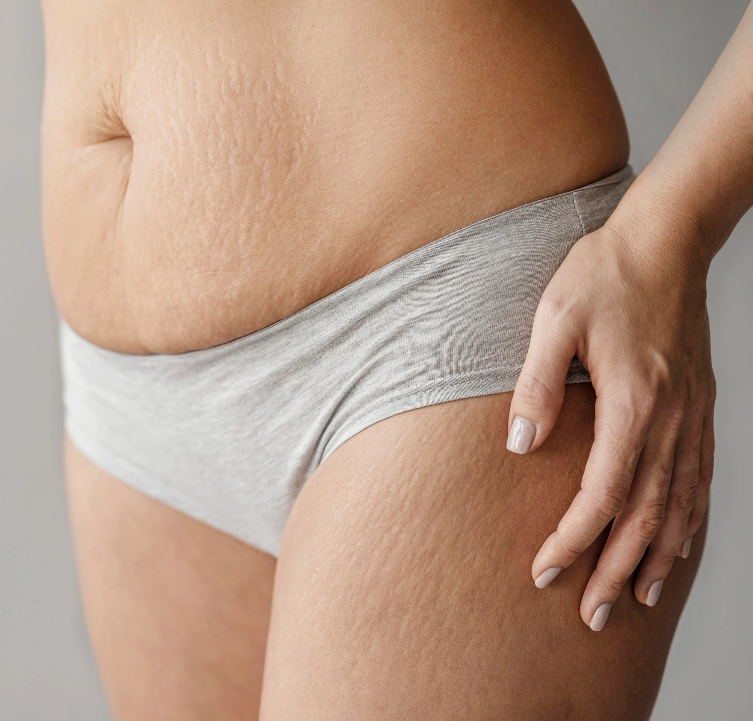 Alimentos que aumentam a celulite