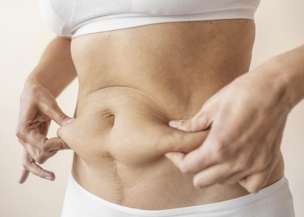 Mulher em plano médio segurando a barriga, ilustrando sintomas de diástase abdominal comuns no pós-parto.