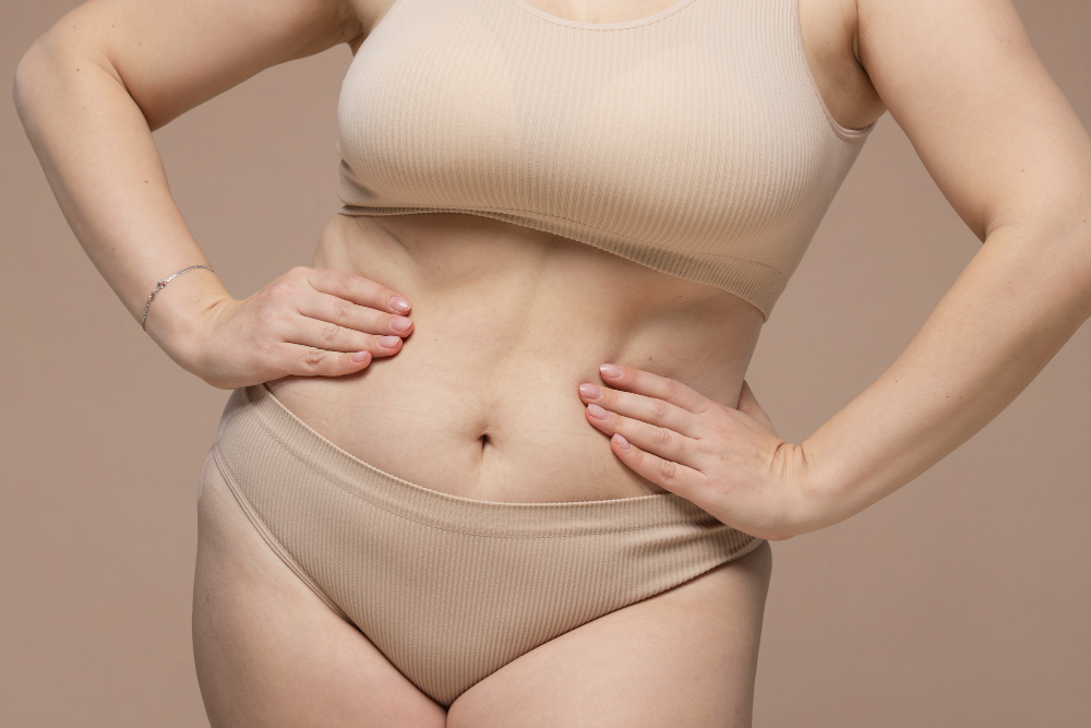 mulher na recuperação da diástase abdominal