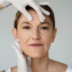 rejuvenescimento facial