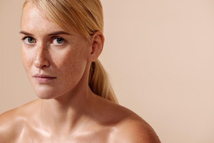 mulher descobrindo como clarear melasma no rosto