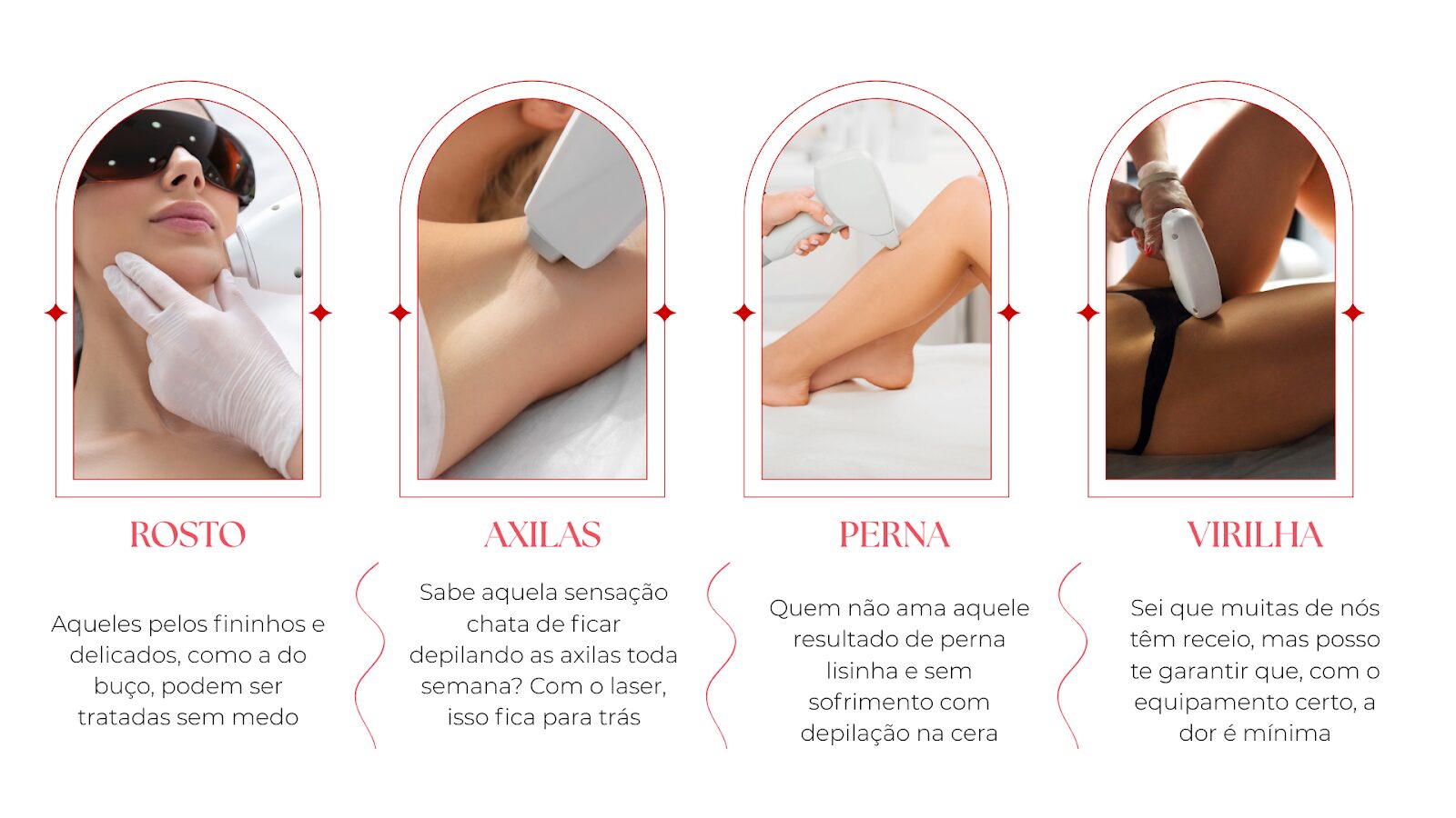 depilação a laser dói? Conheça os locais que podem ser feitos. 