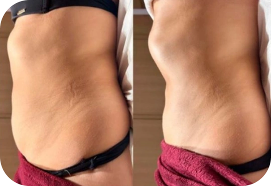 Design-sem-nome-15-(Compressify.io) (2)