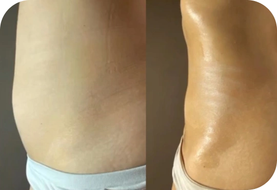 Design-sem-nome-15-(Compressify.io) (3)