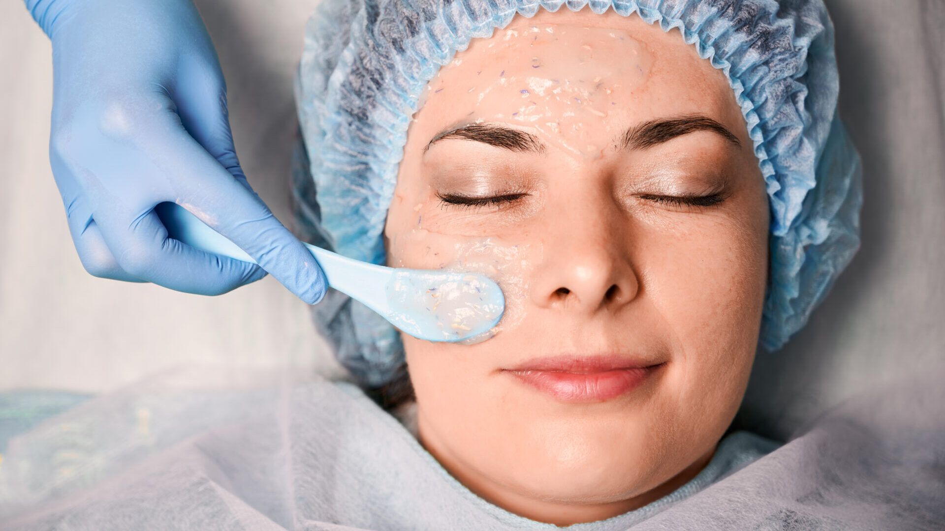 Mulher satisfeita passando por procedimento de peeling para 
manchas
